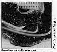 Roundworms and hookworms 