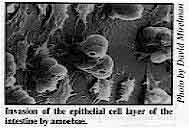 Invasion of the epithelial cell layer of the intestine by amoebae.