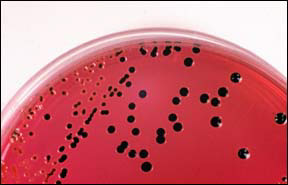 Campylobacter Infection