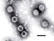 Rotavirus Disease & Vaccines
