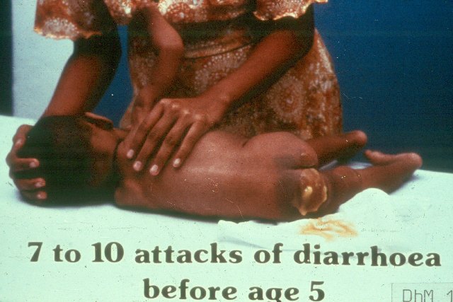 The problem of diarrhoea- slide 1 - Diarrhoea Management