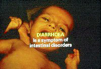 A Simple Solution for Diarrhoea in infants and young children - Slide 22