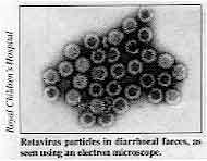 Rotavirus particles in diarrhoeal faeces, as seen using an electron microscope.