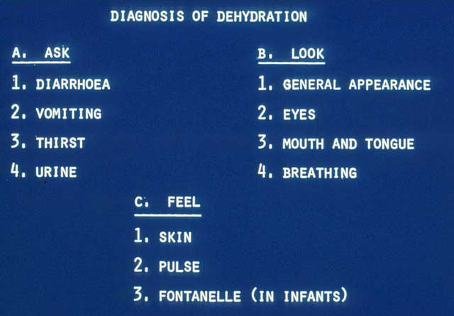 Slide 2 - This slide summarizes the simplest ways to diagnose dehydration.