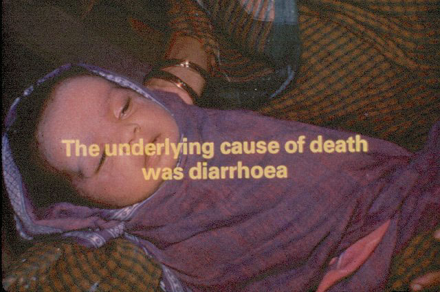 Slide 33 - A Simple Solution to curb the effects of diarrhoea in infants and young children