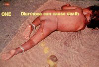 A Simple Solution for Diarrhoea in infants and young children - Slide 113